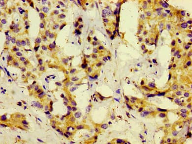 KISS1 / Kisspeptin / Metastin Antibody