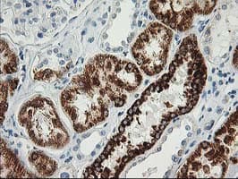 AK4 / Adenylate Kinase 4 Antibody (clone OTI2B12)