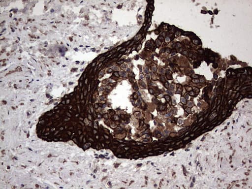 Monoclonal Mouse anti-Human CCL19 / MIP3-Beta Antibody (clone OTI2A12, aa22-98, IHC)