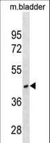 RAB40C Antibody (aa122-148)
