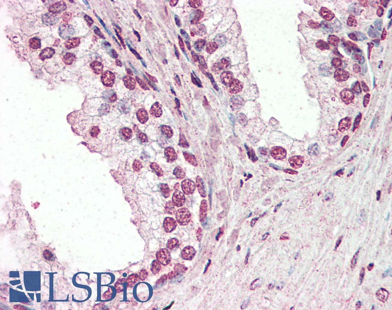 IHC-plus™ Polyclonal Goat anti-Human PIAS2 / PIASX Antibody (aa431-445, IHC)