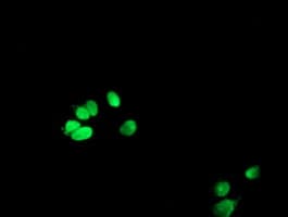 METTL16 / METT10D Antibody (clone OTI1A2)