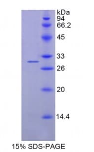 Human AZU1 / Azurocidin Protein (Recombinant His)