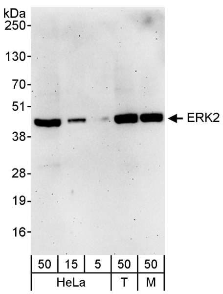 IHC-plus™ Polyclonal Rabbit anti-Human MAPK1 / ERK2 Antibody (aa310-360, IHC, WB)