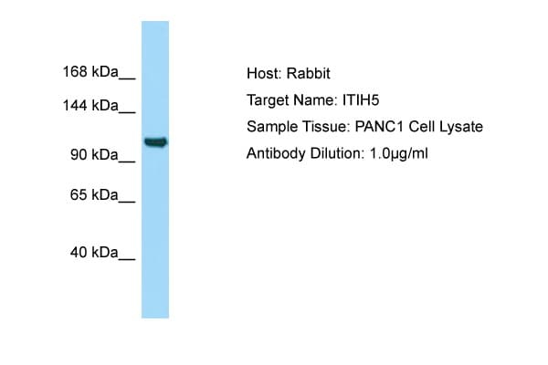 ITIH5 Antibody (aa92-141)