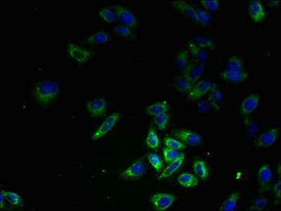 Polyclonal Rabbit anti-Human FPR1 / FPR Antibody (IHC, WB)