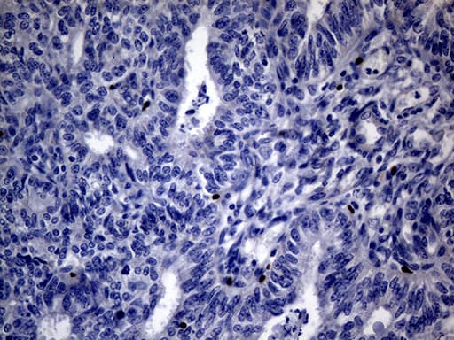 FOXP3 Antibody (clone OTI3D1, Carrier-free)