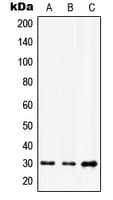IHC-plus™ Polyclonal Rabbit anti-Human HOXD12 Antibody (C-Terminus, IHC, WB)