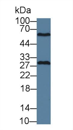 GSTM4-4 / GSTM4 Antibody (aa21-215)