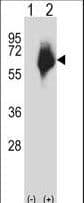 MMP2 Antibody (aa303-331)