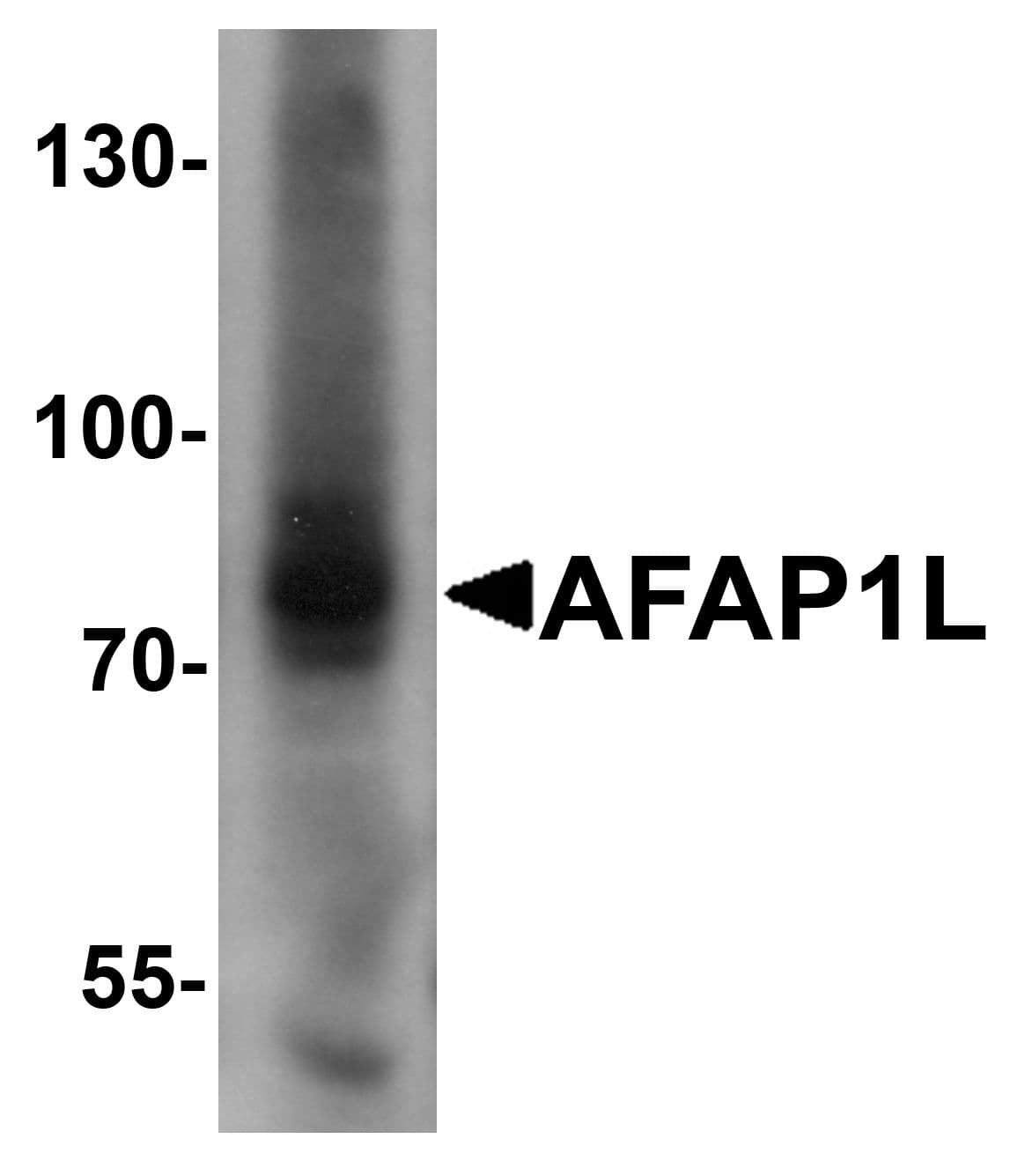 IHC-plus™ AFAP1L1 Antibody