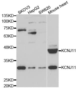Polyclonal Rabbit anti-Human KCNJ11 / Kir6.2 Antibody (IHC, WB)