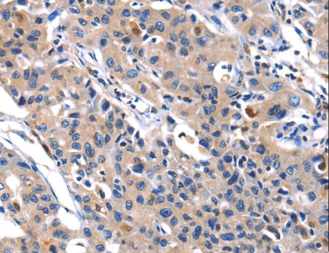 MMP16 Antibody