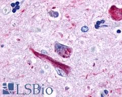 PathPlus™ GPR162 Antibody (Extracellular Domain)
