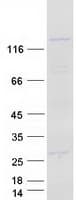 Human PPFIA1 / LIPRIN Protein (Recombinant Myc-DDK (Flag))