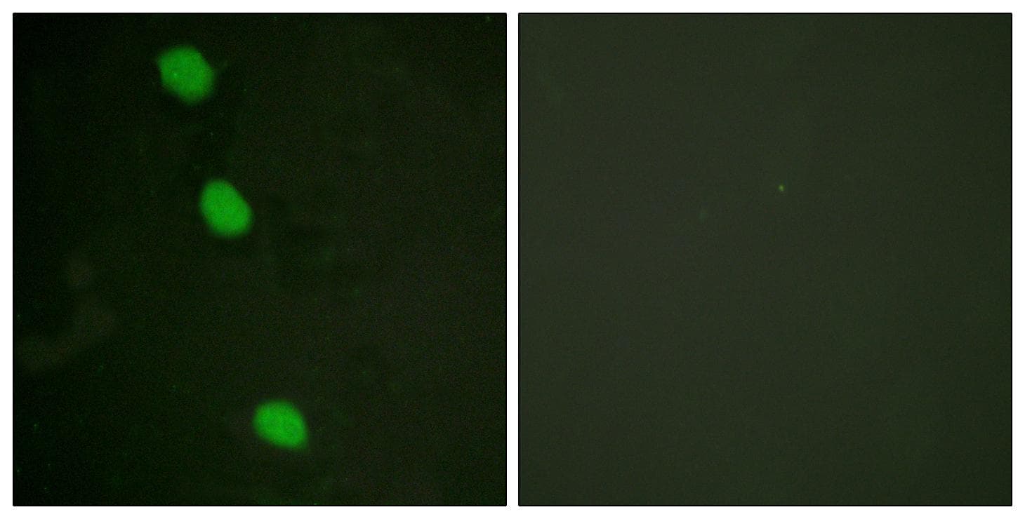 CAMK4 / CaMK IV Antibody (phospho-Thr196/200)