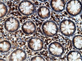 KHK / Ketohexokinase Antibody (clone OTI3D1)