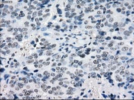 CRYAB / Alpha B Crystallin Antibody (clone OTI6G5)