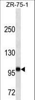 FUT4 / CD15 Antibody (aa425-454)