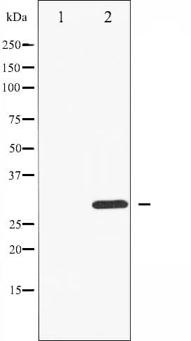 CDK1 / CDC2 Antibody (phospho-Thr14)