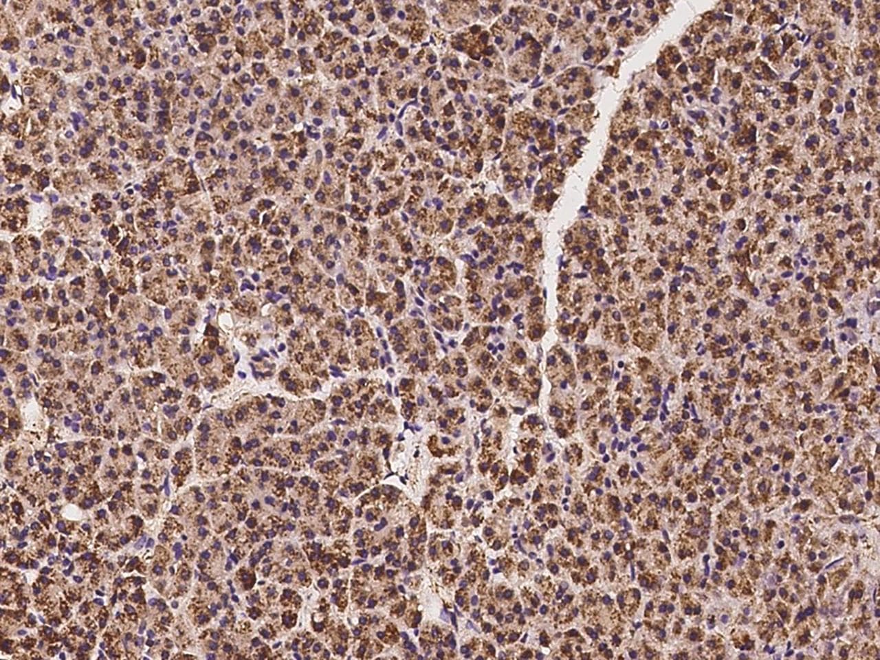 ALDH1L2 Antibody