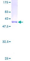 Human GSTT2 Protein (Recombinant GST)