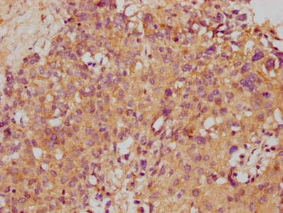 Polyclonal Rabbit anti-Human STX10 / Syntaxin 10 Antibody (IHC)