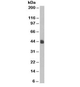 Monoclonal Mouse anti-Human Cytokeratin 5+8 Antibody (clone C-50, IHC, IF, WB)