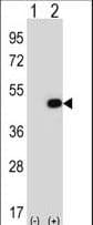 EIF2B3 Antibody (aa344-376)