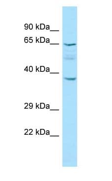 KRT77 / Keratin 77 / KRT1B Antibody (aa338-387)