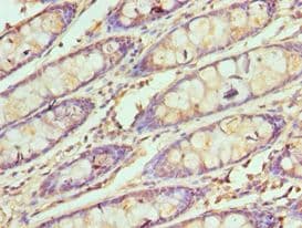 Polyclonal Rabbit anti-Human SMARCB1 / INI1 Antibody (aa86-385, IHC, WB)