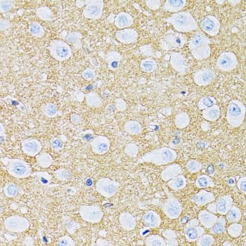 SLC1A2 / EAAT2 / GLT-1 Antibody (aa495-574)