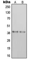 Polyclonal Rabbit anti-Human P2RY14 / GPR105 Antibody (Internal, IHC, WB)