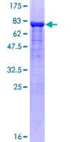 Human SUFU Protein (Recombinant GST)