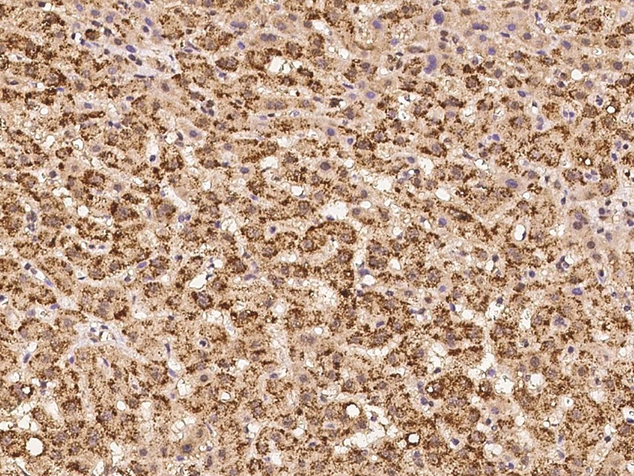 C17orf71 Antibody