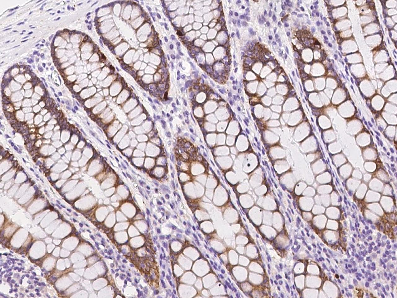 Polyclonal Rabbit anti-Human ZNF410 Antibody (IHC)