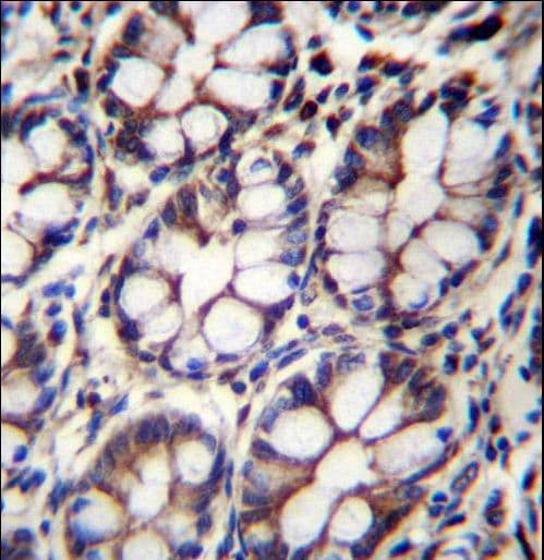 IQCA Antibody (aa794-822)