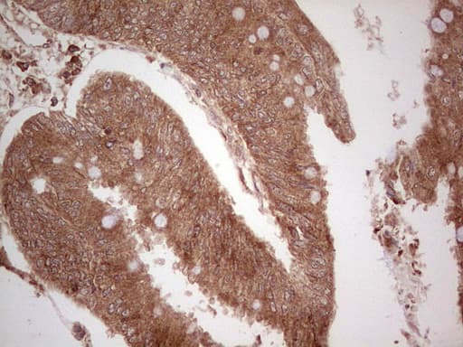UBE2D2 / UBCH5B Antibody (clone OTI2C2)