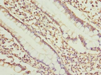 Polyclonal Rabbit anti-Human SGCD / Delta-Sarcoglycan Antibody (IHC, WB)