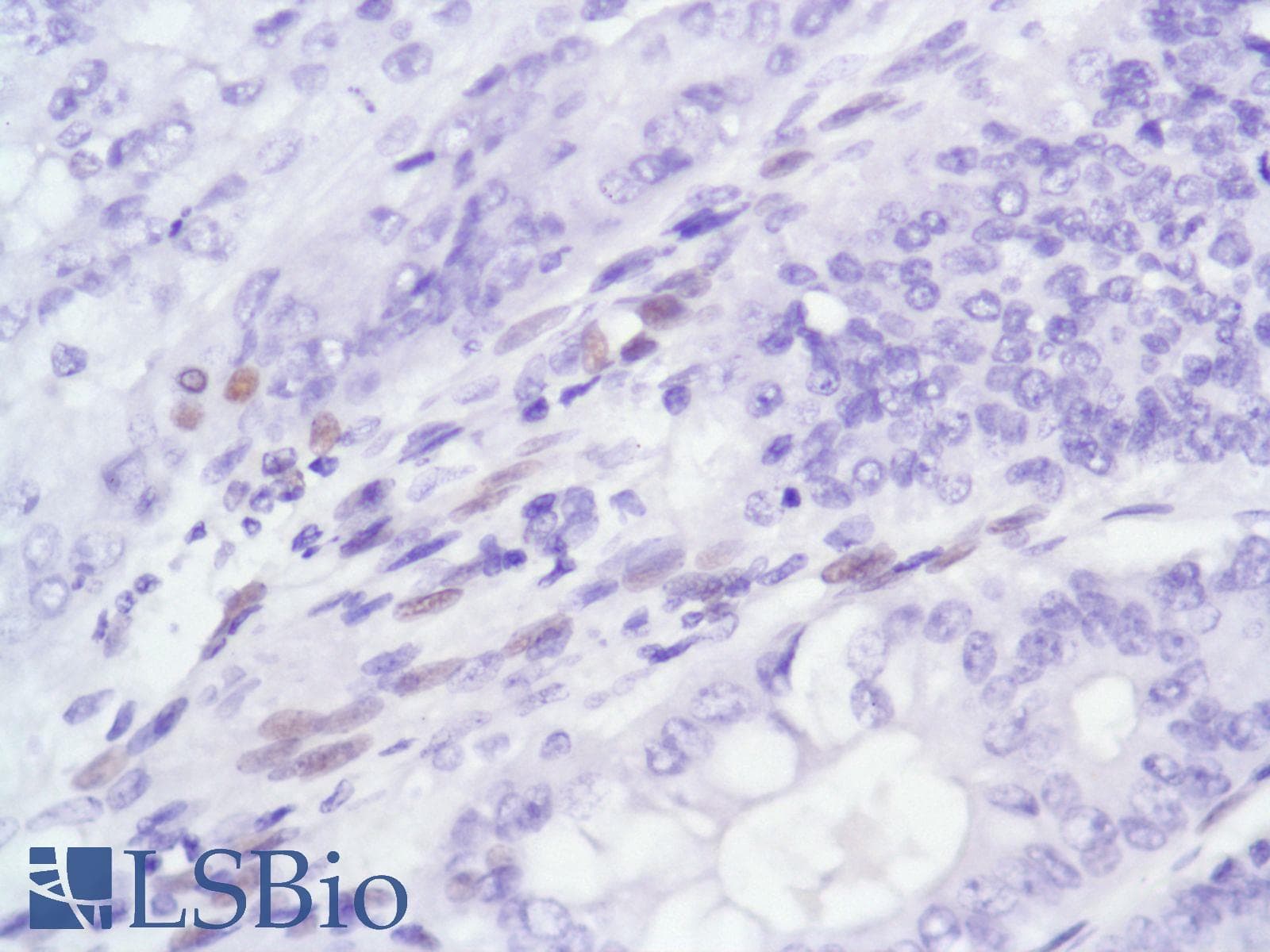 Monoclonal Rabbit anti-Human AR / Androgen Receptor Antibody (clone SP107, N-Terminus, IHC)