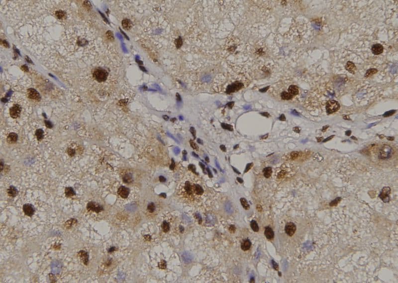 AML1 / RUNX1 Antibody