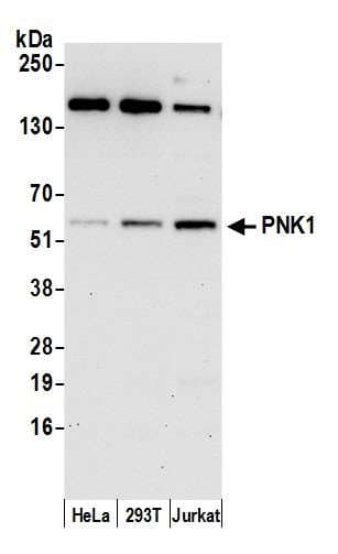 PNKP Antibody (aa100-150)