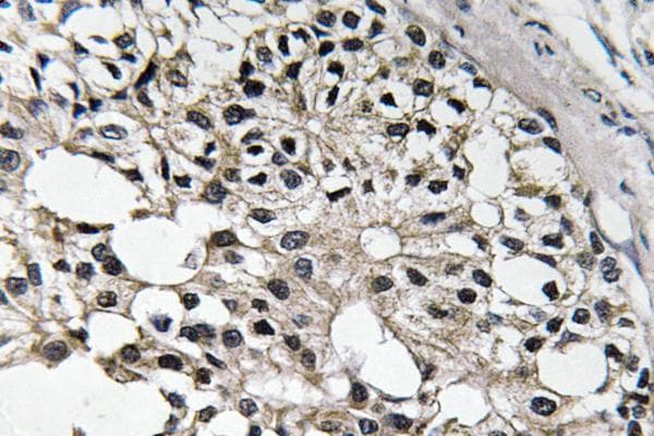 IRS1 Antibody (Glu306)