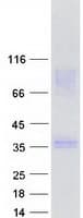 Human SYCE1 Protein (Recombinant Myc-DDK (Flag))