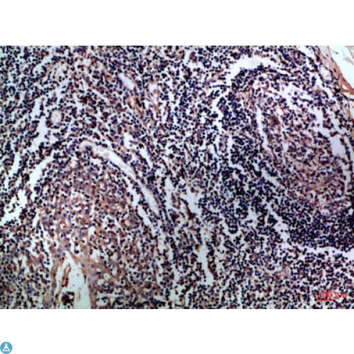 CD1A Antibody
