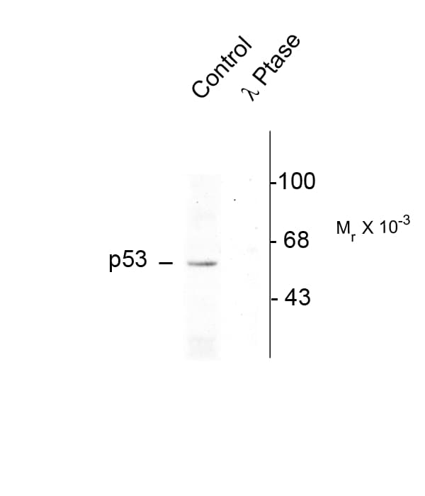 TP53 / p53 Antibody (phospho-Ser392)