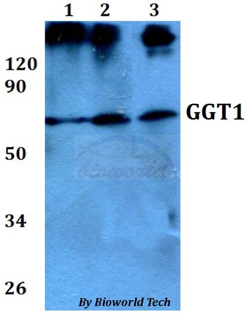 Polyclonal Rabbit anti-Human GGT1 / GGT Antibody (WB)