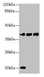 IHC-plus™ STEAP1 / STEAP Antibody (aa3-69)