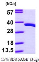 Human PDXP / Pyridoxal Phosphatase Protein (Recombinant His)