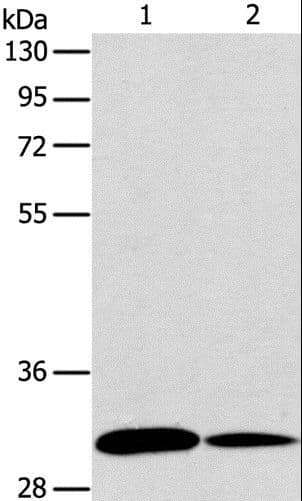 Polyclonal Rabbit anti-Human APG5 / ATG5 Antibody (IHC, WB)